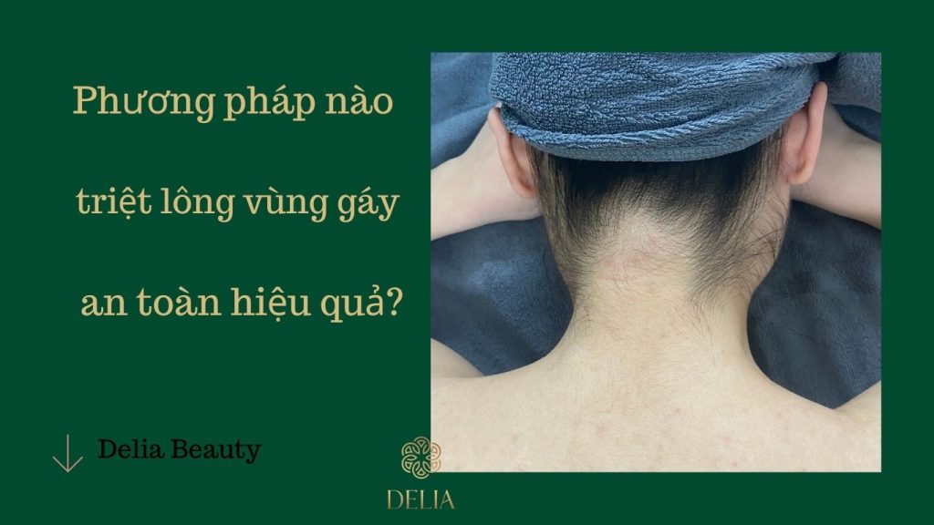 triệt lông gáy